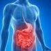 Νόσος του Crohn: Πώς μια απλή εξέταση αίματος μπορεί να την προβλέψει χρόνια πριν την εμφάνιση των συμπτωμάτων