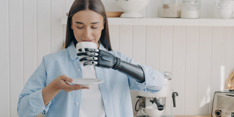 Πώς η τεχνητή νοημοσύνη βοηθά όσους έχουν προσθετικά χέρια να εκτελούν λεπτές κινητικές εργασίες