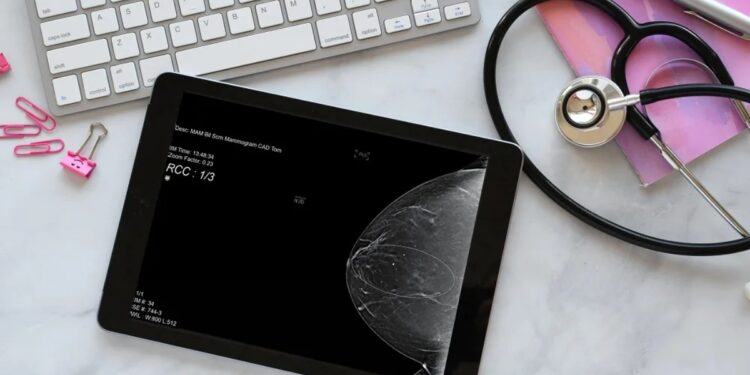 Καρκίνος του μαστού: Νέα δεδομένα αλλάζουν τον τρόπο πρόληψης της νόσου