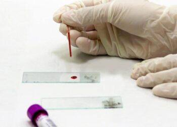 Τεστ αίματος ανιχνεύει τη νόσο του Crohn χρόνια πριν από την εμφάνιση συμπτωμάτων