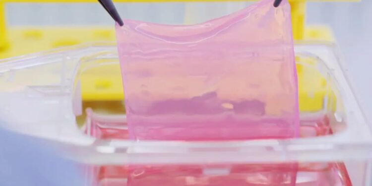 Κραν Μοντανά: Οι επιζώντες λαμβάνουν καινοτόμο θεραπεία με δέρμα που αναπτύχθηκε από τα ίδια τους τα κύτταρα