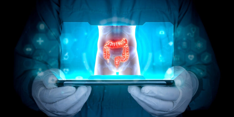 4 πρώιμα συμπτώματα του καρκίνου παχέος εντέρου που θα έπρεπε να γνωρίζουν όλοι οι νέοι