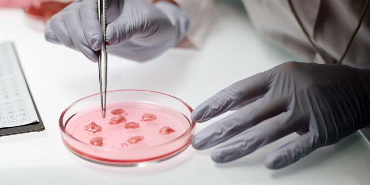 Ζήτημα δημόσιας υγείας η μικροβιακή αντοχή σε βακτήρια που μεταδίδονται μέσω τροφίμων