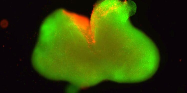 Ερευνητές ανέπτυξαν οργανοειδή νωτιαίου μυελού
