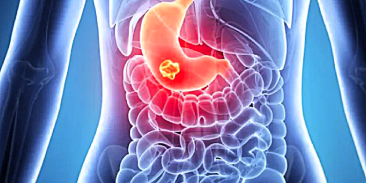 Με πεπτικά προβλήματα συνδέεται το άγχος κατά την πρώιμη παιδική ηλικία