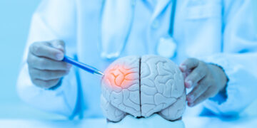 Εγκεφαλικό στον ύπνο: Πώς μπορείς να το καταλάβεις