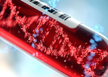 Αύξηση αιματολογικών καρκίνων έπειτα από τη θεραπεία άλλου καρκίνου διαπιστώνει έρευνα