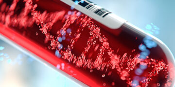 Αύξηση αιματολογικών καρκίνων έπειτα από τη θεραπεία άλλου καρκίνου διαπιστώνει έρευνα