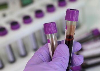 Παγκόσμια πρωτιά: Κυτταρική θεραπεία «επαναπρογραμμάτισε» το ανοσοποιητικό σύστημα μιας γυναίκας με τρία αυτοάνοσα νοσήματα