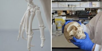 Επιστήμονες μετέτρεψαν μαλλί σε βιώσιμο υλικό για την αναγέννηση οστών