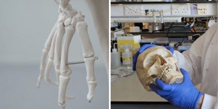 Επιστήμονες μετέτρεψαν μαλλί σε βιώσιμο υλικό για την αναγέννηση οστών