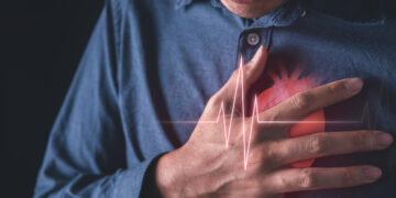 Προσοχή: Αυτό το «αθώο» σύμπτωμα μπορεί να κρύβει κολπική μαρμαρυγή