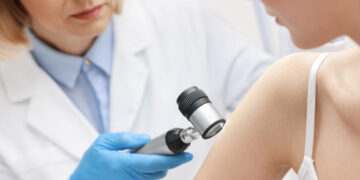 Δερματικό επίθεμα σκοτώνει τα καρκινικά κύτταρα του μελανώματος χωρίς να χρειάζεται χειρουργείο