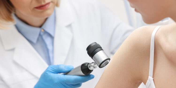 Δερματικό επίθεμα σκοτώνει τα καρκινικά κύτταρα του μελανώματος χωρίς να χρειάζεται χειρουργείο