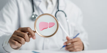 Λίπος στο συκώτι: Όλα όσα πρέπει να γνωρίζετε για τη λιπώδη νόσο του ήπατος