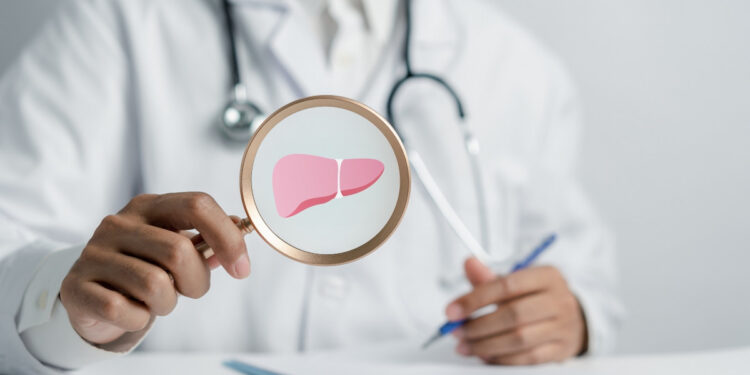 Λίπος στο συκώτι: Όλα όσα πρέπει να γνωρίζετε για τη λιπώδη νόσο του ήπατος