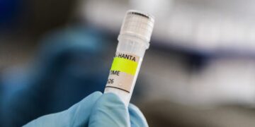 Χανταϊός: Η Moderna επιταχύνει την ανάπτυξη εμβολίου mRNA