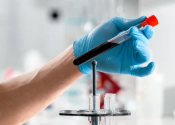 Νέα κυτταρική θεραπεία προσφέρει ελπίδα σε ασθενείς με ηπατική νόσο