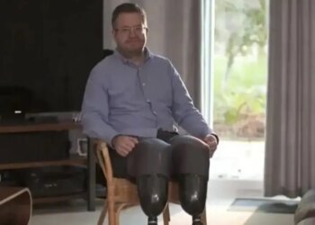 Βρετανία: Γιατρός ακρωτηρίασε τα πόδια του για να ικανοποιήσει αρρωστημένο φετίχ του