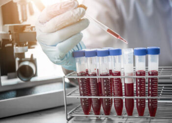 Χοληστερόλη: Η παρεξηγημένη τροφή που τελικά δεν την ανεβάζει