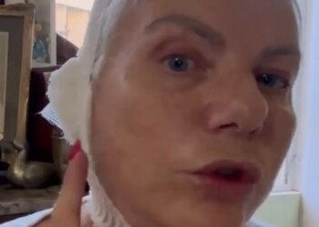 Η Νανά Παλαιτσάκη έκανε λίφτινγκ στον λαιμό: «Ο γιατρός αφαίρεσε αυτή την χαλάρωση που με ενοχλούσε»