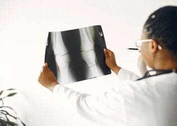 Οστεοπόρωση: Νέα ευρήματα δίνουν ελπίδες για αποτελεσματικότερη αντιμετώπιση της πάθησης
