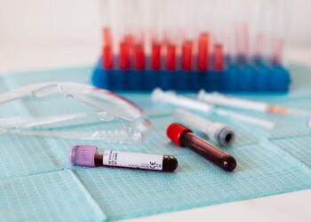 Το άγχος μπορεί να αλλάξει τη δομή του αίματος, διαπιστώνει μελέτη
