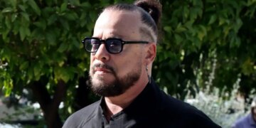 Ο Χρήστος Δάντης για το ατύχημα που είχε στο χέρι: «Το σπάσιμο ήταν δυνατό, έκανα δύο χειρουργεία»
