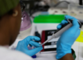 HIV – Συναγερμός από τον ΟΗΕ για νέα έξαρση της επιδημίας: «Δεκαετίες προόδου κινδυνεύουν»