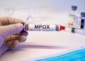 Mpox: Ο ιός εξαπλώνεται σε νέες χώρες – Πώς μπορεί να περιοριστεί η νέα έξαρση