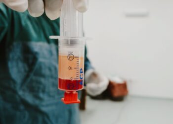 Πλασμαφαίρεση: Τι είναι, πώς, γιατί και πού επιτρέπεται να πραγματοποιηθεί