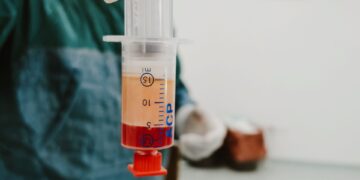 Πλασμαφαίρεση: Τι είναι, πώς, γιατί και πού επιτρέπεται να πραγματοποιηθεί